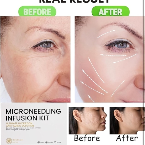 Micro Infusion Derma Kit with Peptide Hydrating Anti-Aging (2 Serums + 1 micro) - Picture 7 of 15